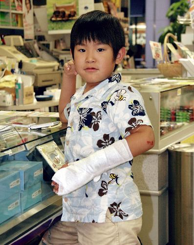 息子が骨折!!